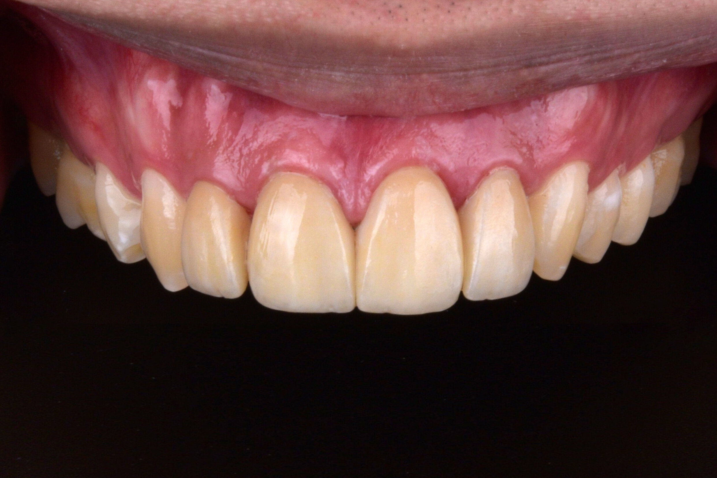 Dental Background