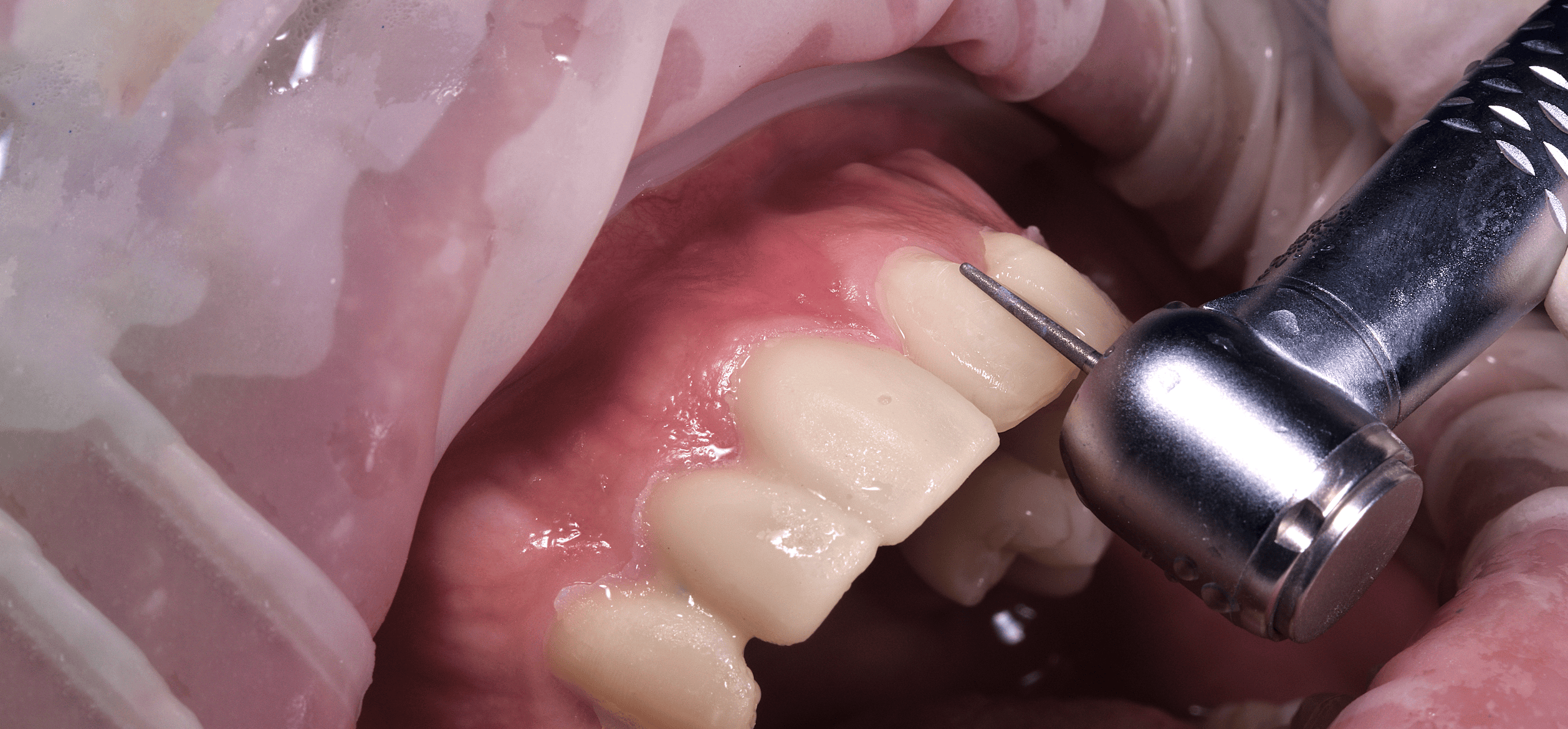 Dental Gallery Background